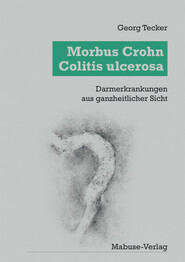 Morbus Crohn - Colitis Ulcerosa