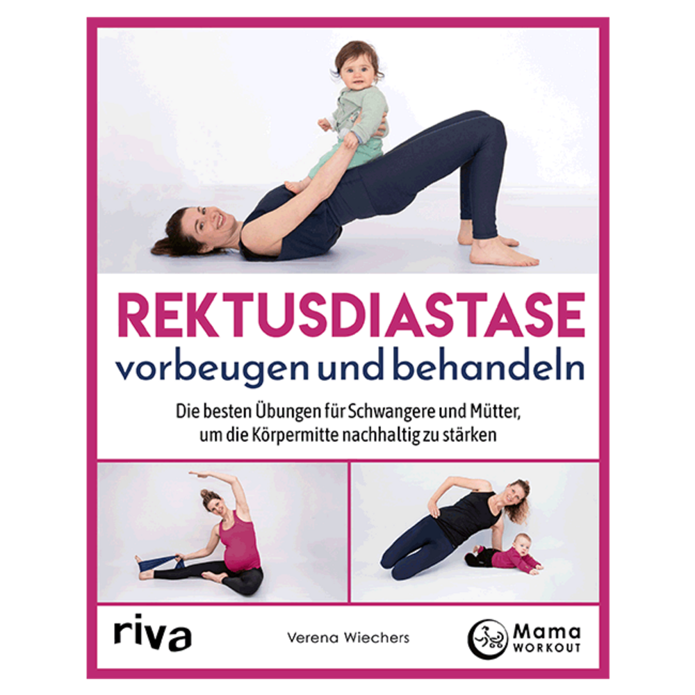 Rektusdiastase vorbeugen und behandeln